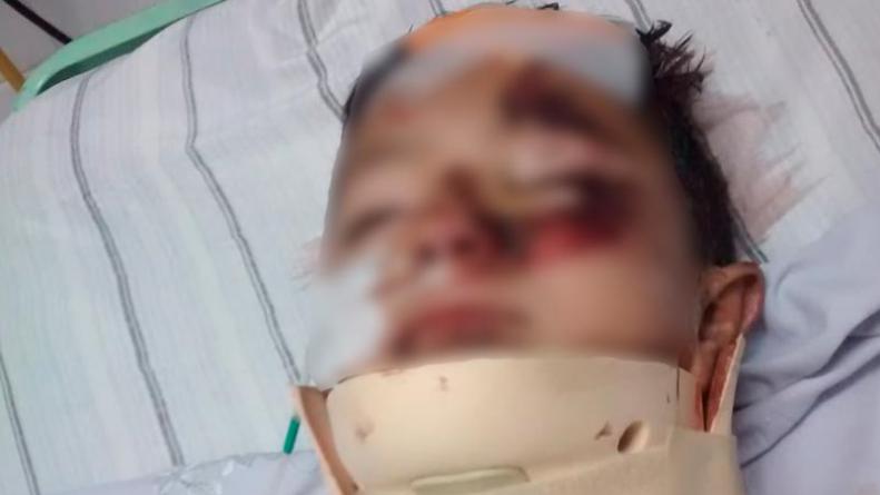 nene-terapia-intensiva-accidente-la-calera