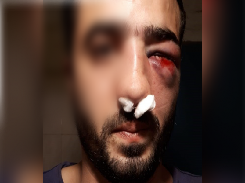 verdulero golpeado0