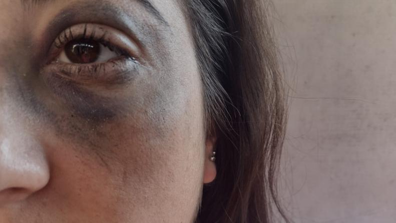 denuncia policia golpes 1