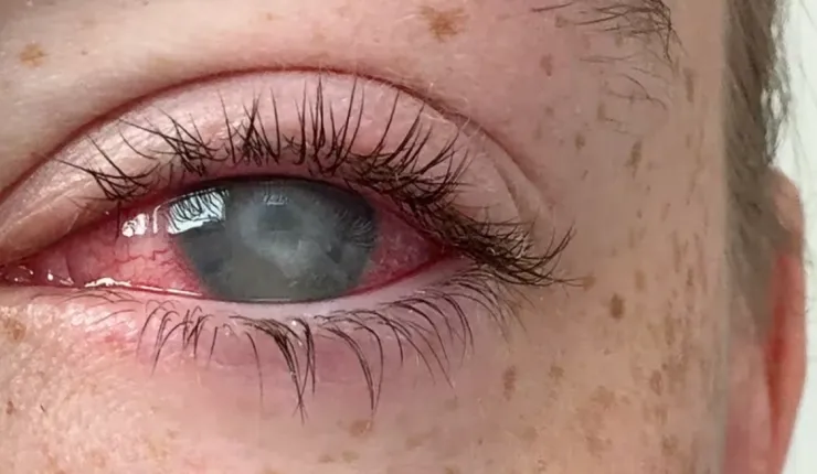 image-9-2-740x430