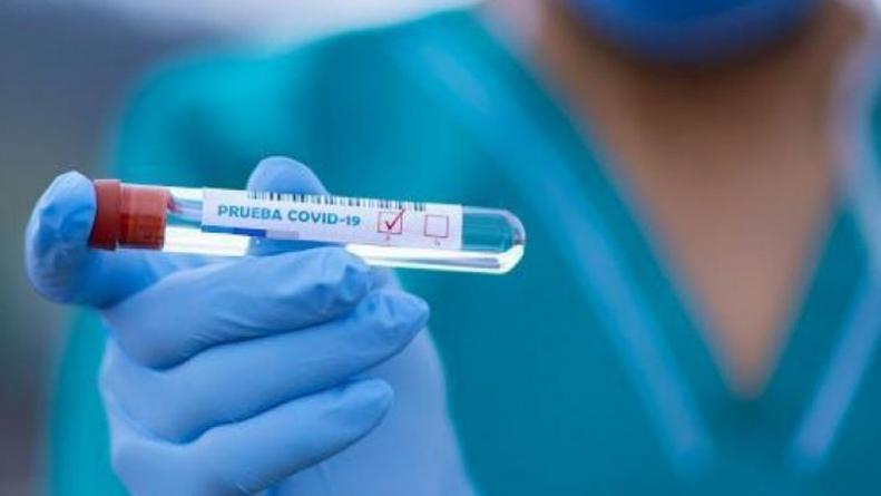 casos-coronavirus-cordoba-muertes-argentina-salud
