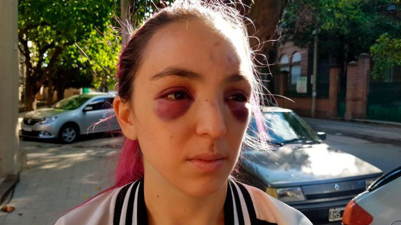 chica-golpeada-barrio-pueyrredon
