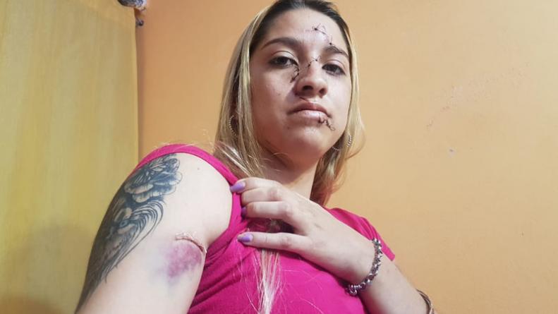 joven-atacada-botellazos-barrio-pueyrredon