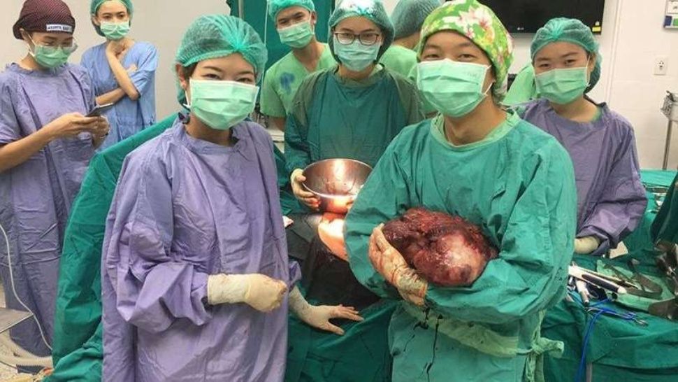 tumor
